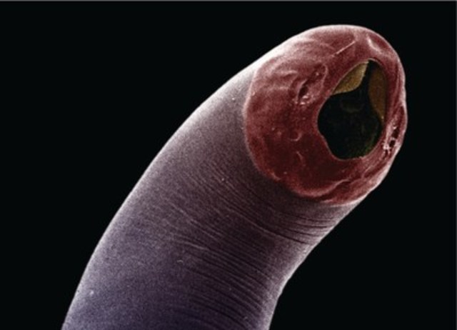 CNW | Que sont les parasites intestinaux et pourquoi devrais-je m'en préoccuper?